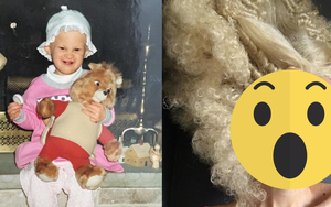 Mắc bệnh hiếm gặp từ khi mới lọt lòng, cuộc sống ở tuổi 33 của cô gái mang vẻ ngoài dị biệt bây giờ ra sao mà ai cũng phải nể phục