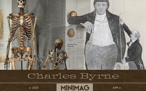 Bộ xương Người khổng lồ Ireland: Tấn bi kịch gây tranh cãi nhất lịch sử Anh Quốc