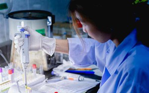 Nghiên cứu Đại học Oxford: Ăn thịt gà thường xuyên làm tăng nguy cơ mắc 3 loại ung thư nhưng có cách ăn để giảm nguy hiểm