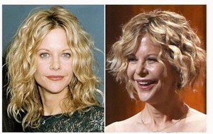 Muốn trẻ mãi không già, những celeb biến dạng khủng khiếp vì phẫu thuật thẩm mỹ