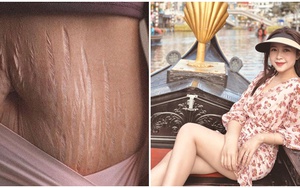 Vợ Phan Văn Đức đăng ảnh vết rạn sau sinh, nói lên tiếng lòng của người làm mẹ khiến cộng đồng mạng xúc động