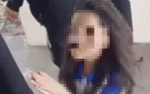 Cứu sống bé gái muốn tự tử vì bị bạn cùng lớp đánh hội đồng dã man: Bác sỹ BV Nhi lo ngại hậu quả khôn lường từ bạo lực học đường