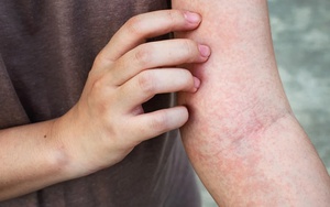 3 vị trí trên cơ thể hay bị "ngứa ngáy" nhiều khả năng do đường huyết vượt quá tiêu chuẩn, kiểm soát ngay trước khi quá muộn