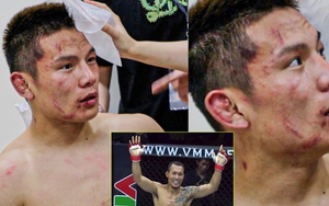 Võ sĩ Lý Tiểu Long của Trung Quốc bầm dập, ngơ ngác sau thất bại chóng vánh trước Trần Quang Lộc