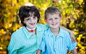 Từ nhỏ đã bị xa lánh, gọi là "quái vật" vì ngoại hình méo mó, cuộc sống của cậu bé nguyên mẫu phim Wonder bây giờ ra sao?