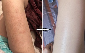 Cô nàng loại bỏ viêm nang lông, da sần sùi ngay tại nhà với combo sữa tắm + lotion body