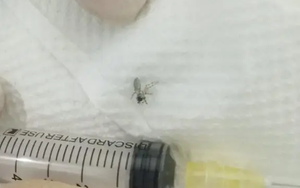 Người phụ nữ bị ù, lãng tai nên đi khám, bác sĩ nội soi ngỡ ngàng thấy "8 con mắt" đang nhìn ra