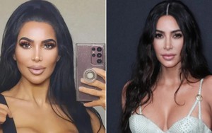 Nghiện phẫu thuật thẩm mỹ đến biến dạng,"bản sao" Kim Kardashian tử vong thương tâm