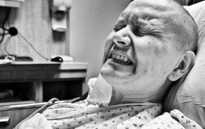 Thứ trưởng Bộ Y tế: 'Cứ sau 10 năm, chi phí điều trị bệnh ung thư tăng 1,5 - 2 lần'