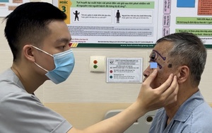 5 dấu hiệu của nốt ruồi cảnh báo ung thư, có 1 nên đi khám sớm