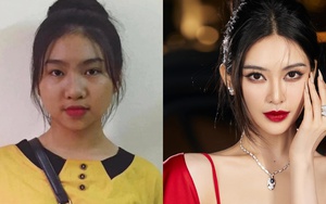 Lan truyền hình ảnh trước khi phẫu thuật thẩm mỹ của “bản sao Phạm Băng Băng”