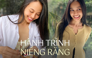 9x niềng răng: Dành dụm 25 triệu để có nụ cười rạng rỡ, ám ảnh mãi câu nói "mỗi lần em cười là anh sợ phát khiếp"