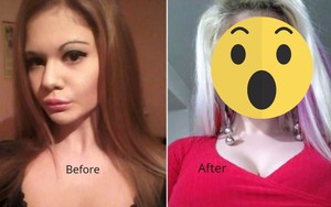 Chê diện mạo xinh đẹp, cô gái trẻ nghiện PTTM khiến người khác hết hồn với ngoại hình quái dị trị giá hơn 580 triệu