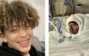 Nghịch dại theo thử thách trên mạng xã hội, thanh niên 16 tuổi bị bỏng 75% cơ thể, khó có khả năng bình phục