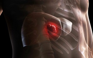 Đợi triệu chứng mới đi khám ung thư gan là đã muộn, cách đơn giản 'chỉ điểm' bệnh sớm ai cũng cần biết