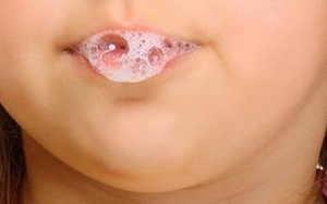 Thực hư bôi nước bọt vào buổi sáng lên vùng da mụn có thể khiến mụn 'biến mất'