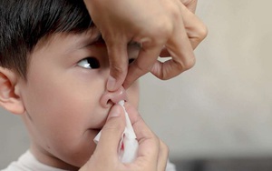 Chuyên gia cảnh báo gần 20% trẻ dưới 5 tuổi bị thiếu máu