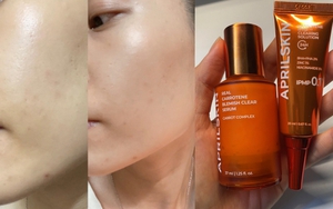 Đánh giá cặp đôi giúp giảm mụn chiết xuất cà rốt: Hiệu quả thấy rõ chỉ sau 2 tuần, tuy nhiên vẫn có 1 điểm trừ nhỏ 