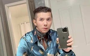 Lý do khiến mặt Kasim Hoàng Vũ biến dạng