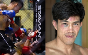 Nguyễn Trần Duy Nhất hứng chịu 39 cú đấm trong 20 giây nhưng vẫn lật kèo giành chiến thắng, CĐV gọi anh là ‘vua lì đòn’