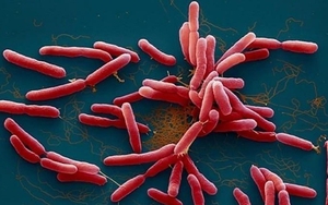  Hiểu đúng về bệnh Whitmore và cách phòng bệnh