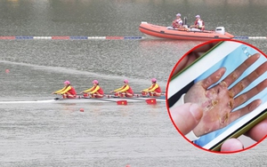 Cận cảnh bàn tay biến dạng của nhà vô địch ASIAD môn chèo thuyền, nhiều CĐV nổi da gà, xót xa