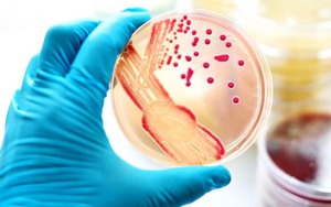 Chuyên gia y tế khuyến cáo các biện pháp phòng ngừa bệnh đậu mùa khỉ