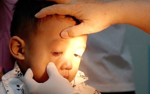 Sở Y tế TP.HCM xác định nguyên nhân nhiều người đau mắt đỏ