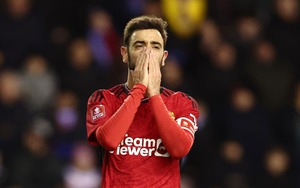 Khi MU không dám 'coi thường' Cúp FA