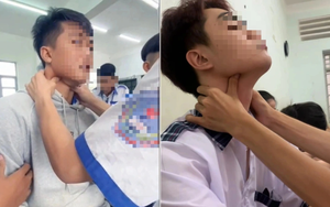 Cảnh báo trò chơi nguy hiểm "bắt pen" ở giới trẻ