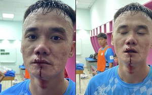Toàn cảnh vụ cựu tuyển thủ Việt Nam mặt bê bết máu sau vụ ẩu đả với cầu thủ trẻ TPHCM