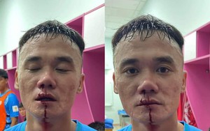 Hai cầu thủ đánh nhau ở giải hạng Nhất chính thức bị phạt nặng