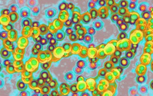 Các ca nhiễm liên cầu khuẩn tăng lên mức cao kỷ lục tại Nhật Bản 