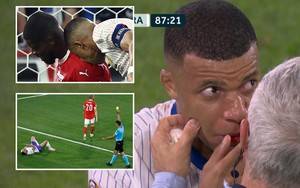 Tin nóng EURO 18/6: Mbappe lên tiếng về sự cố gãy mũi ở EURO, cầu thủ đầu tiên nhận án phạt nguội