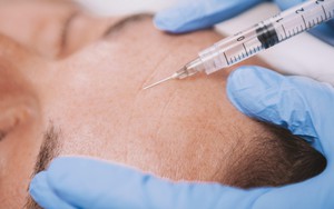 Nữ bệnh nhân 30 tuổi gần như bị mù mắt sau tiêm filler làm đẹp