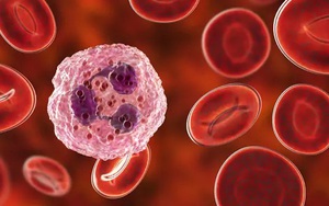 Nga công bố ca điều trị ung thư máu thành công đầu tiên bằng loại thuốc mới