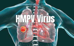 Ấn Độ phát hiện trường hợp đầu tiên nhiễm virus HMPV