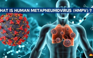 Kazakhstan ghi nhận hàng chục ca nhiễm virus HMPV