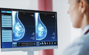 Công nghệ hình ảnh siêu nhạy giúp phát hiện ung thư sớm