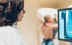 Cảnh báo ung thư vú gia tăng ở phụ nữ dưới 40 tuổi