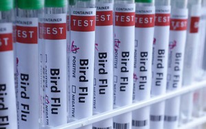 Nga cảnh báo dịch cúm A tiếp tục gia tăng