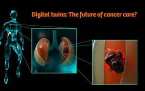 Thử nghiệm điều trị ung thư bằng AI và công nghệ song sinh kỹ thuật số