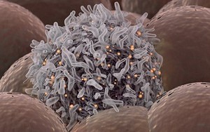 Hy vọng mới trong điều trị ung thư hiếm gặp ở trẻ em