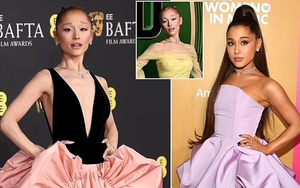 Ariana Grande bất ngờ đăng tải hình ảnh gầy gò đáng báo động