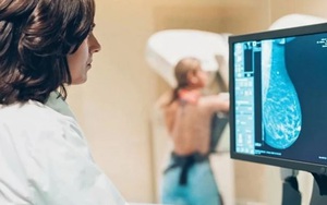 Phát hiện mới cải thiện hiệu quả điều trị cho bệnh nhân ung thư vú