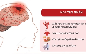 Cảnh báo đột quỵ ở người trẻ tuổi