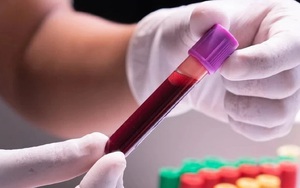 Chưa có bằng chứng khoa học về lọc máu có thể phòng ngừa các bệnh liên quan đến mỡ máu, đột quỵ