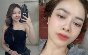 Ca sĩ Dương Hoàng Yến bị liệt dây thần kinh số 7 ngoại biên