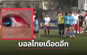 Tức giận vì bị đuổi, cầu thủ Thái Lan đấm trọng tài, hành hung đối phương suýt mù mắt