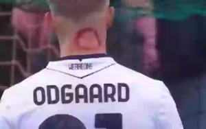 Cầu thủ Serie A hé lộ sự thật về 'vết cắn zombie' bí ẩn